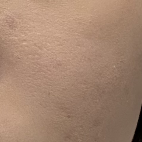 薄肌乾燥肌ニキビ跡肌向けのコンシーラー探してますby 依留さんの画像