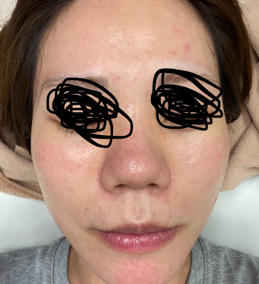 肌改善、何からすべきかby acchiiさんの画像