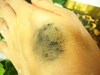 2010-07-21 23:45:22 by みとらんさん 2010-07-21 23:45:22 by みとらんさん