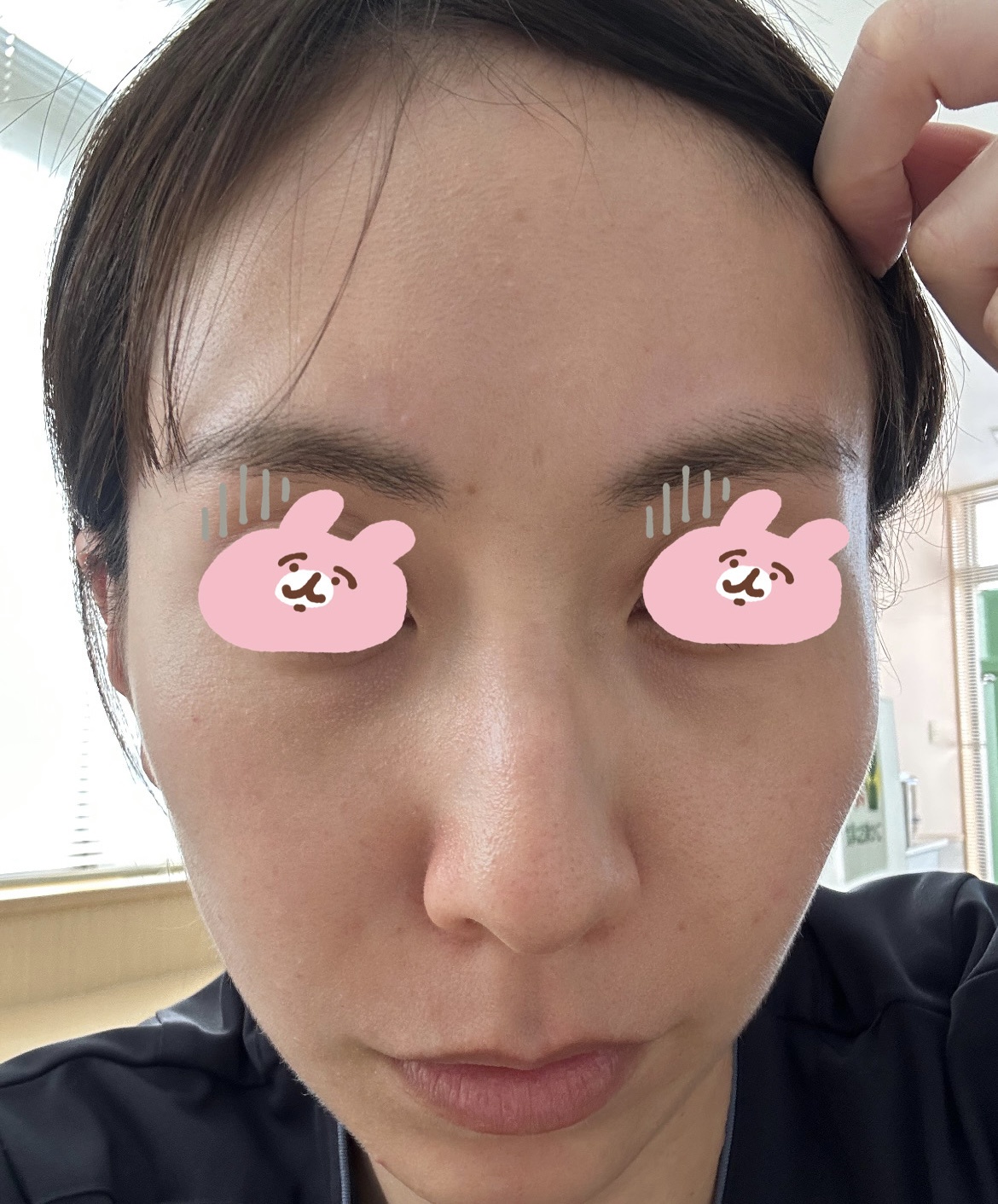 汚い肌をすみませんby mrck__0126さんの画像