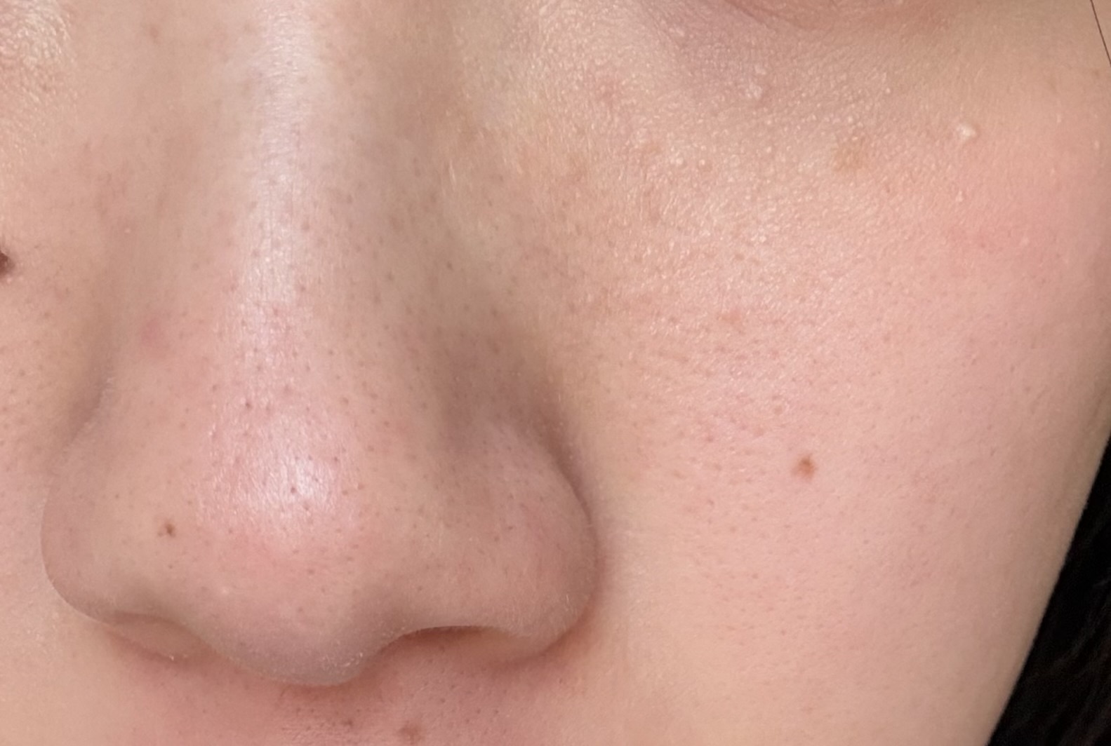 毛穴などby 匿名さんの画像