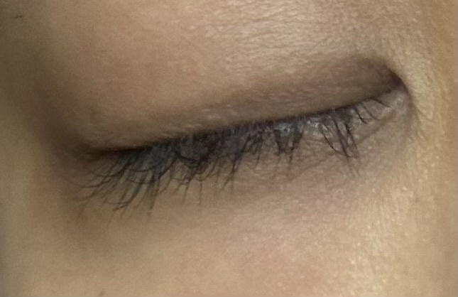 まぶたの色by 匿名さんの画像