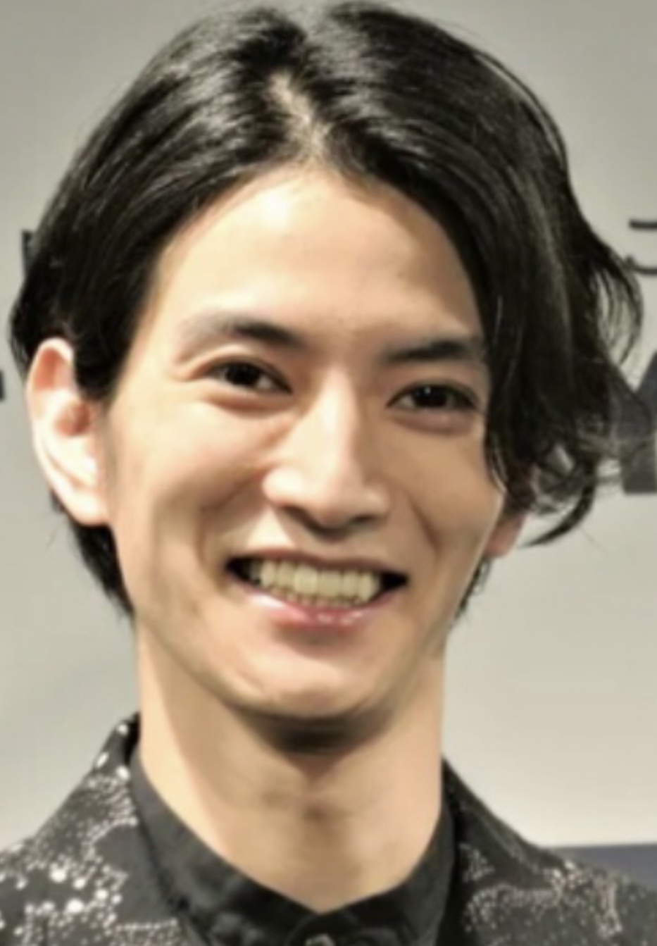 面長って丸顔と比べるとシワができやすいですか? by 匿名さん の画像