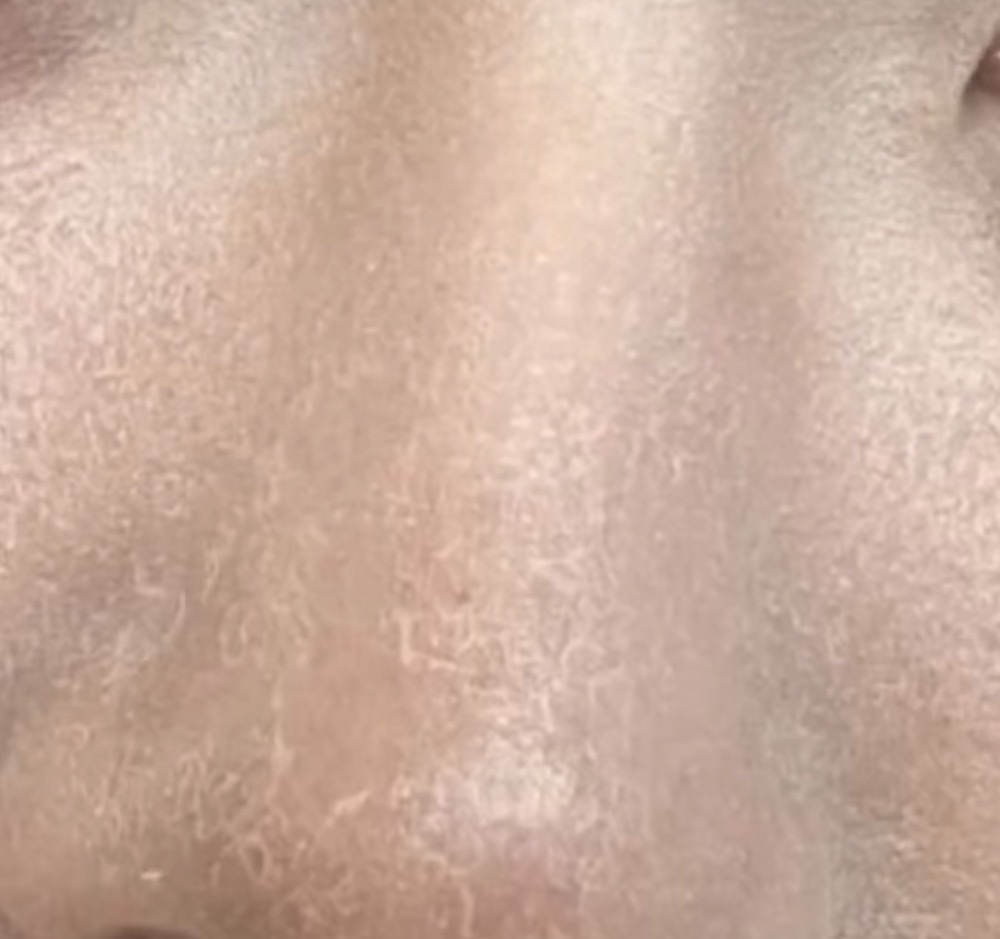 20歳女 乾燥がやばいのにクリーム美容液合わない by 匿名さん の画像