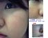 2011-10-19 10:09:17 by depressionさん