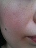 �G�g���H�X / �|���|���~�l�����`�[�N�iby ��큙����j