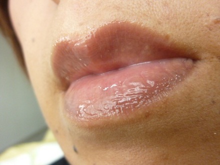�G�b�Z���X���b�v�x�[�X by �R������������