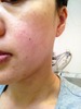 �V���L�[���C�X�g�t�@���f�[�V���� by ��������񁙂���