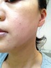 �V���L�[���C�X�g�t�@���f�[�V���� by ��������񁙂���