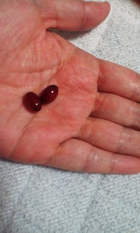 ファンケル コエンザイムq10 60粒 ファンケル 格安 浅野幸せのブログ