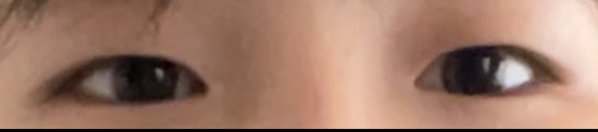 まぶたの厚さ(すみません、3回目でこれが正しいです…!) by らららて8278さん の画像