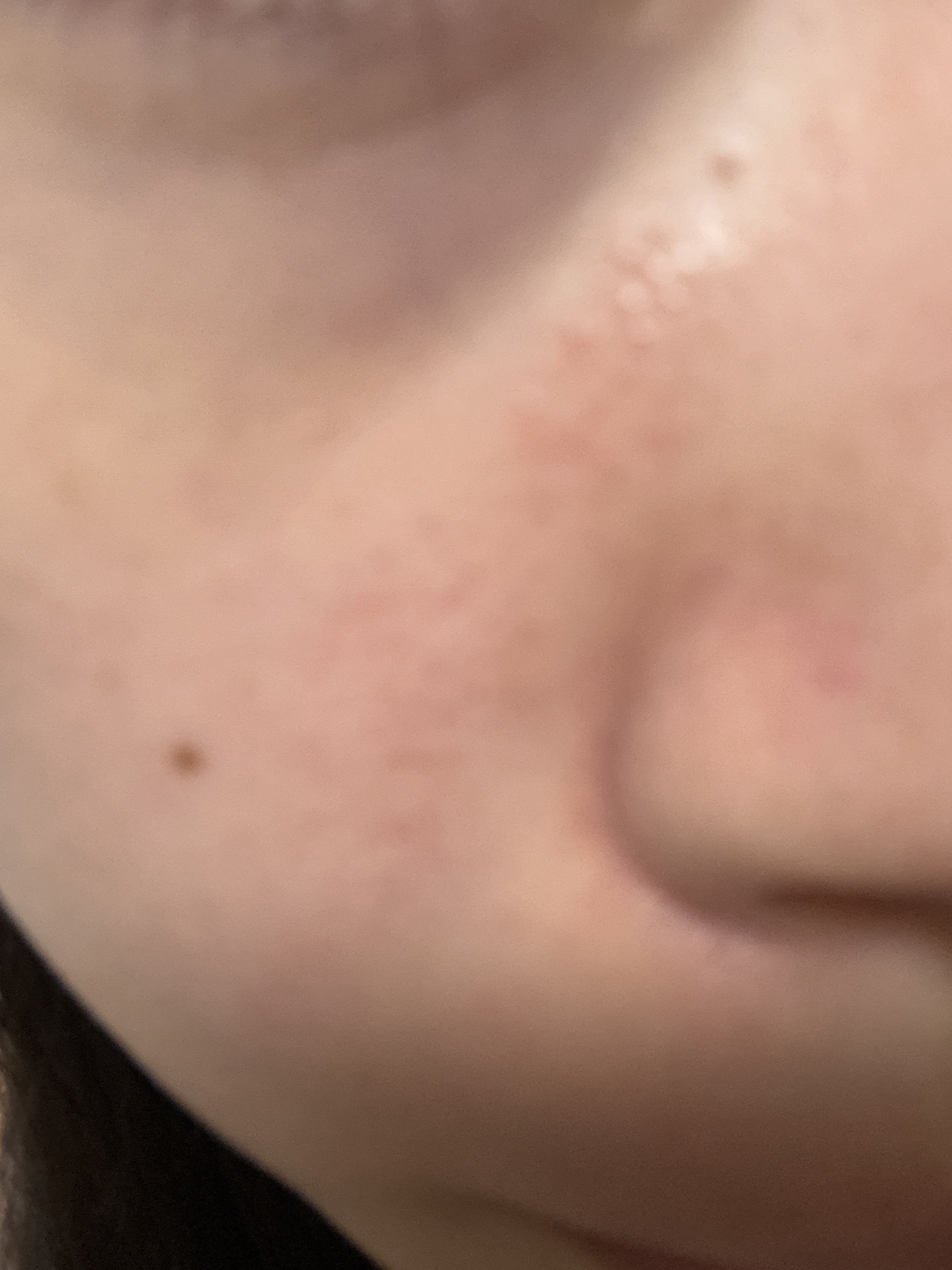 この赤みをちょっとでも抑えたいby m_m9999さんの画像