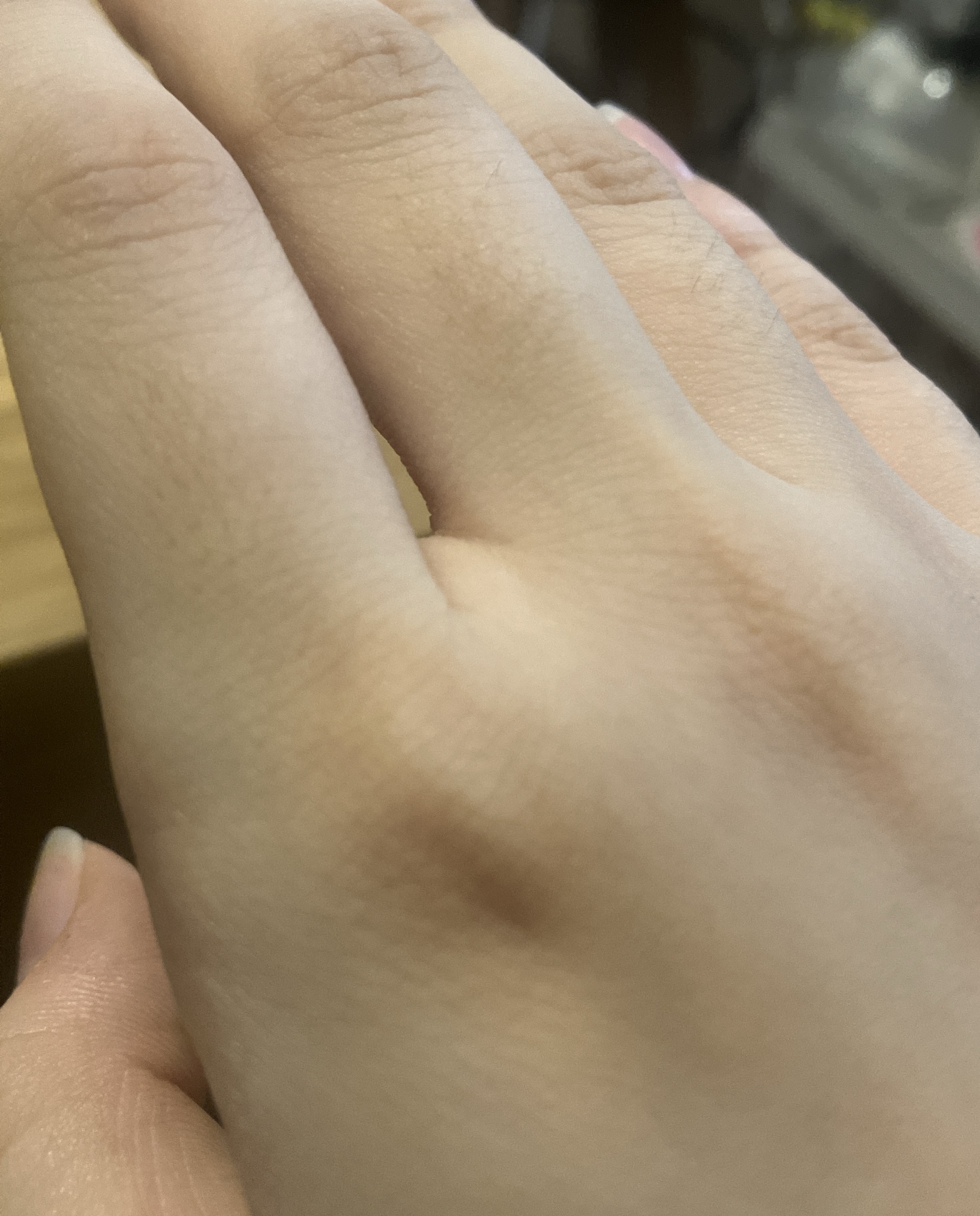 指毛をめだたなくさせたい by オバケの8823さん の画像