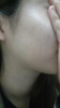skin of age28 by dlpn����