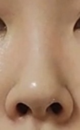 上向き(穴見えまくり)団子鼻 ノーズシャドウについて by 匿名さん の画像