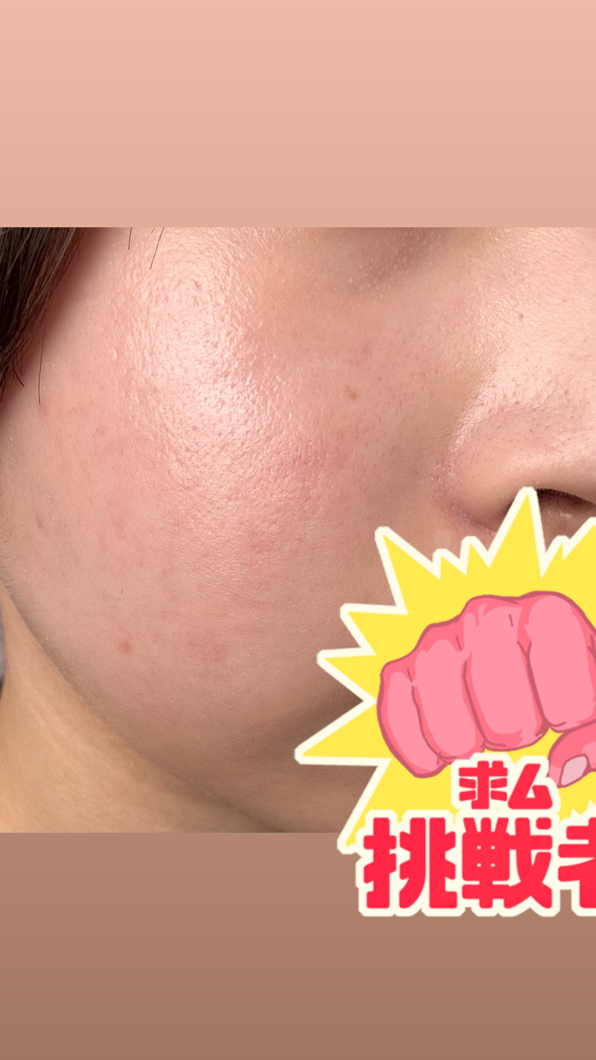 肌質改善by 匿名さんの画像
