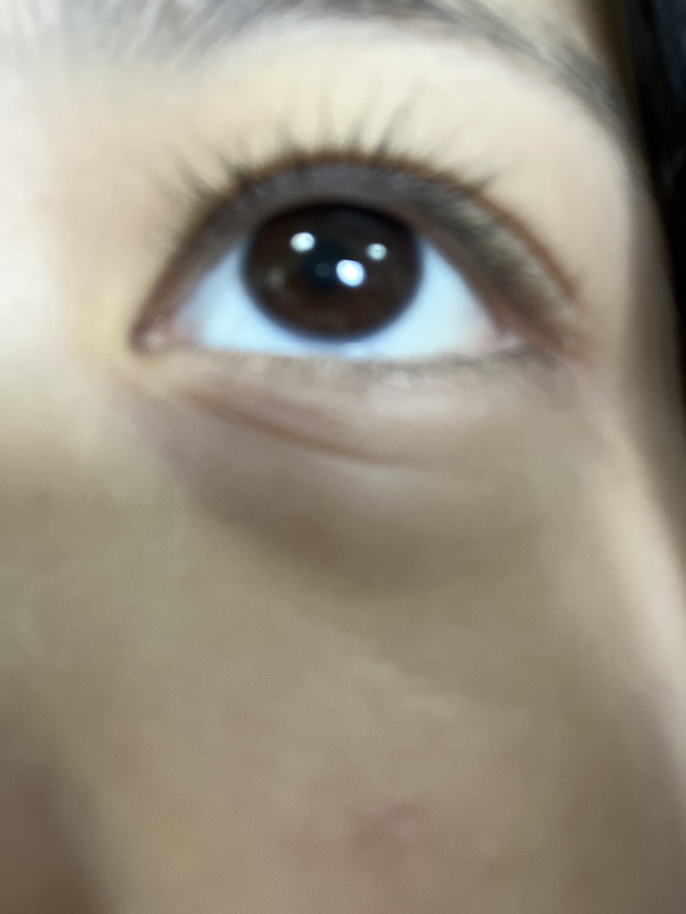 目のシワ?線? by p3798さん の画像