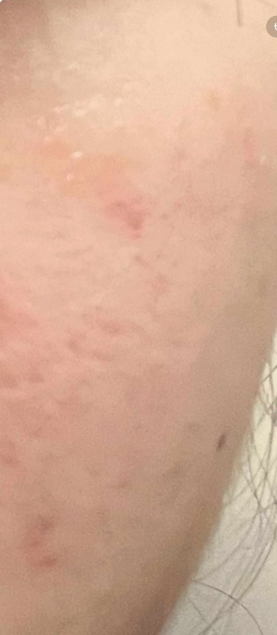 ザラつきby ばっ2343さんの画像