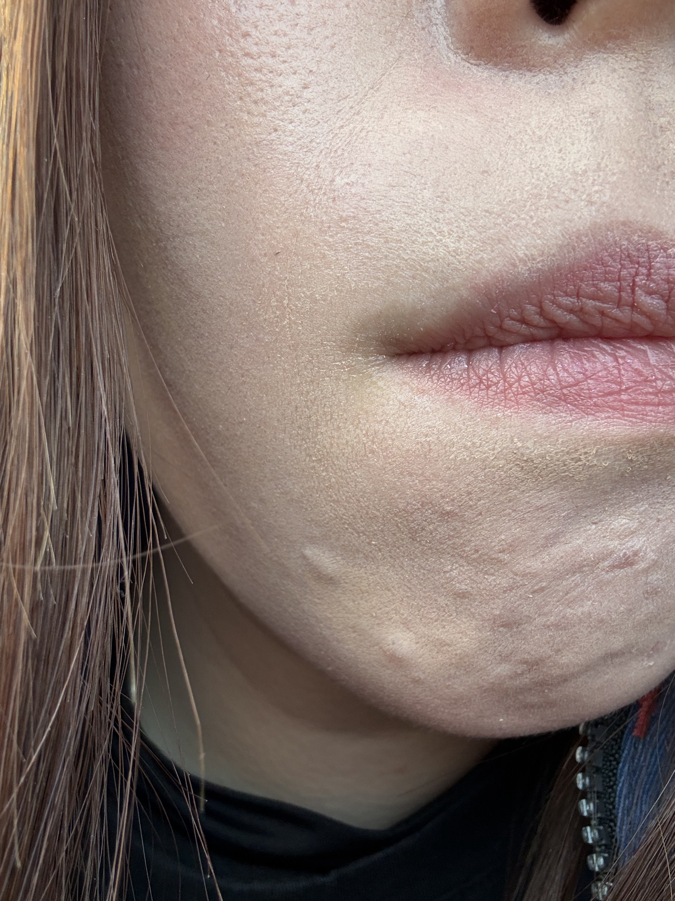 脂性肌崩れなのか、乾燥肌崩れなのかby みなこんんんさんの画像