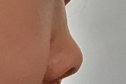 鼻の低さのコンプレックスby にゃんこfamilysさんの画像