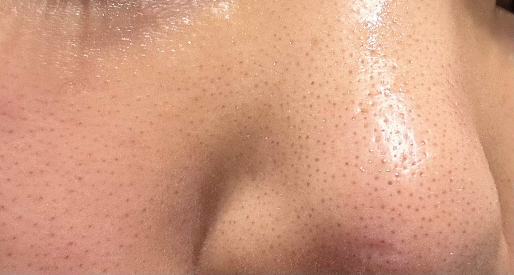 洗顔後のスキンケアも教えていただきたいです! by Evnさん の画像