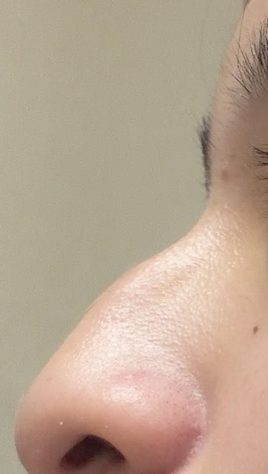 鼻 by りりか7400さん の画像