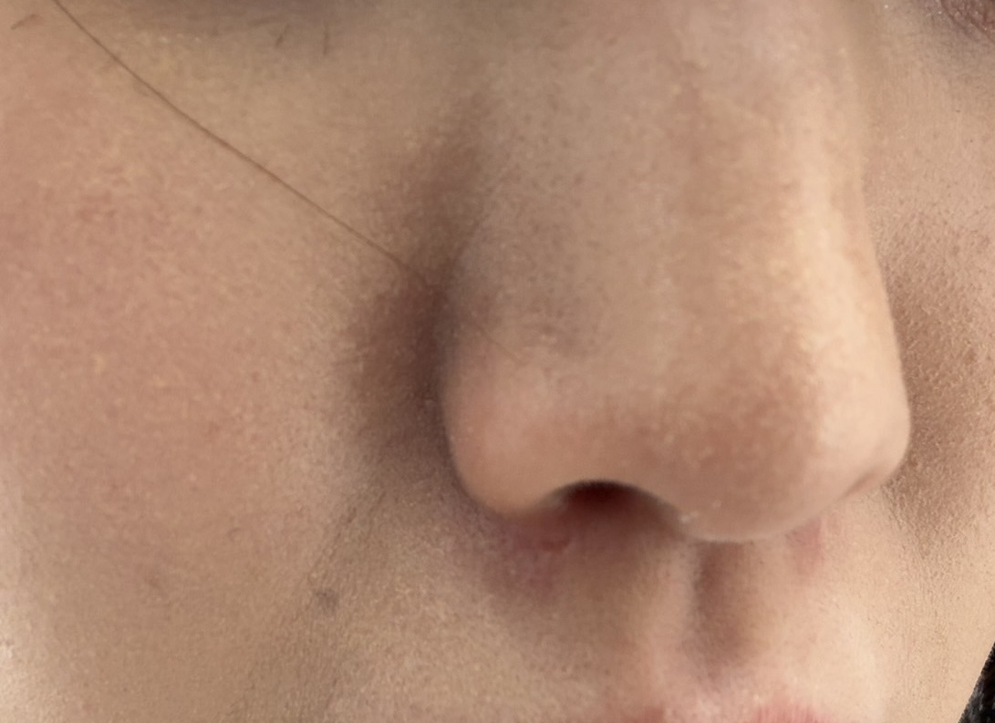 乾燥崩れについてby つき483さんの画像