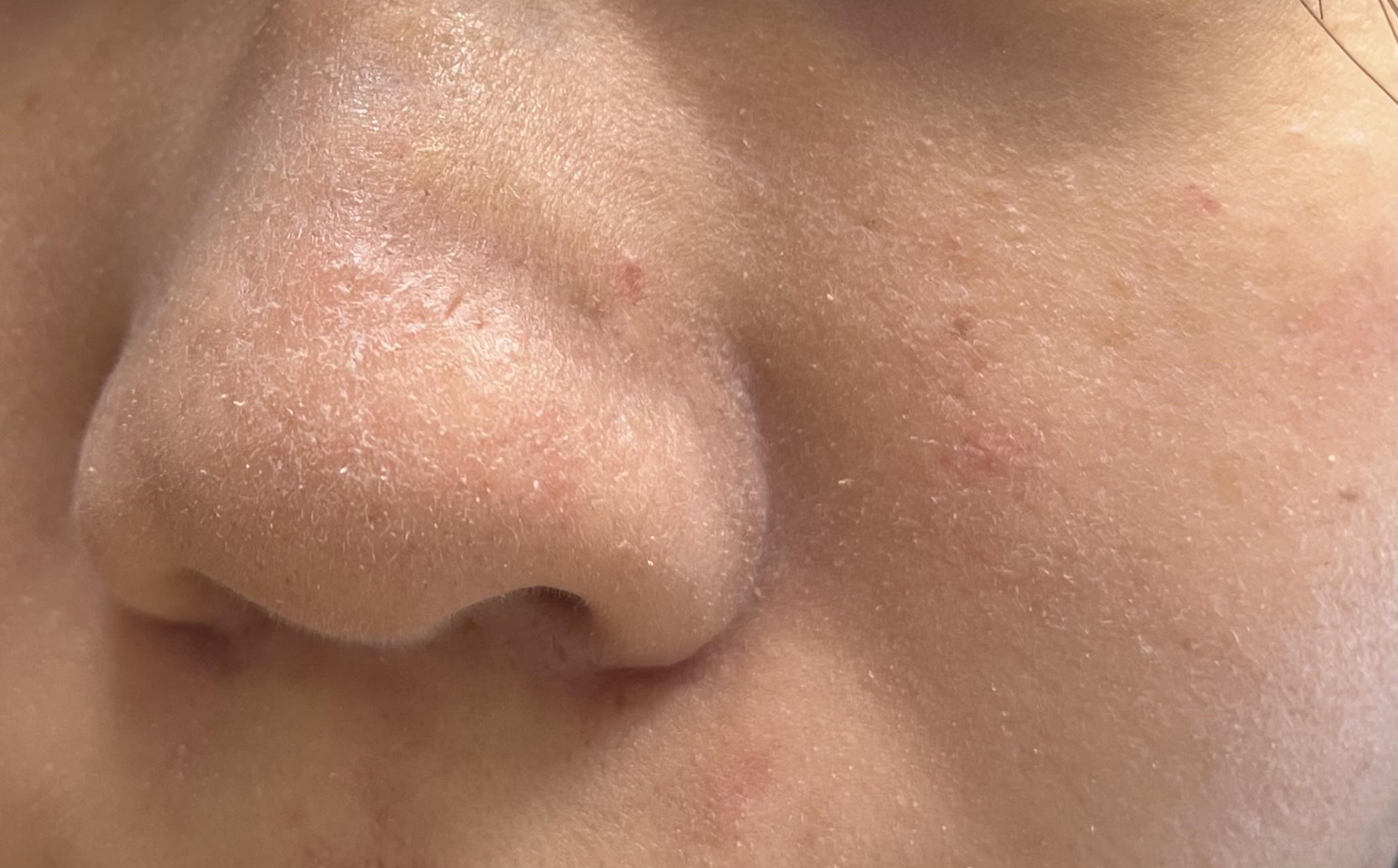 ベースメイクについてby 匿名さんの画像