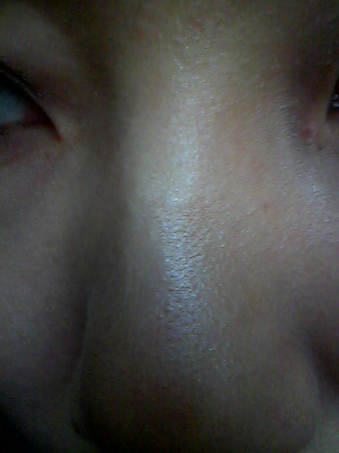 肌のぷつぷつ by **にゃむにゃむ**さん の画像