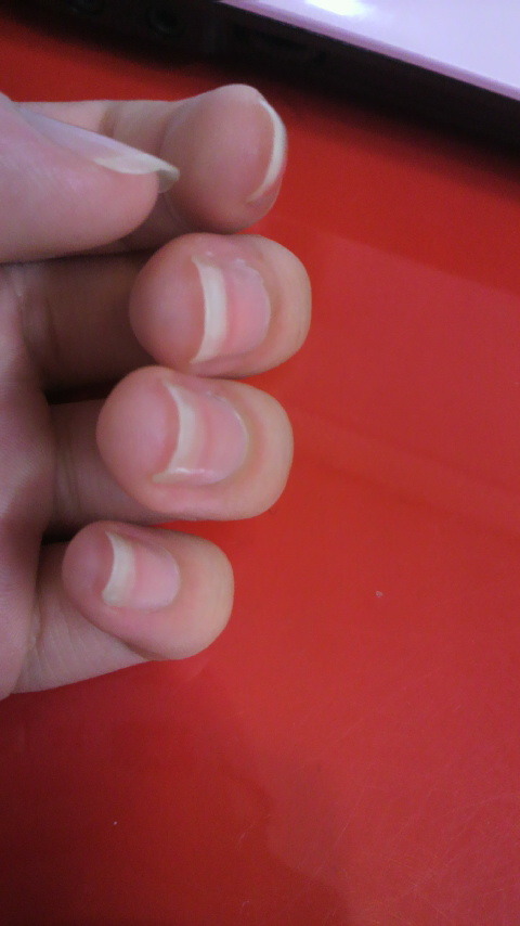 爪の形 by aliceeeさん の画像