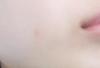 DHC / ��p �A�N�l�P�A �R���V�[���[�iby kaede*����j