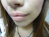 �����[�V���J / �p�[�t�F�N�g�O���X�iby �N���X����悳��j