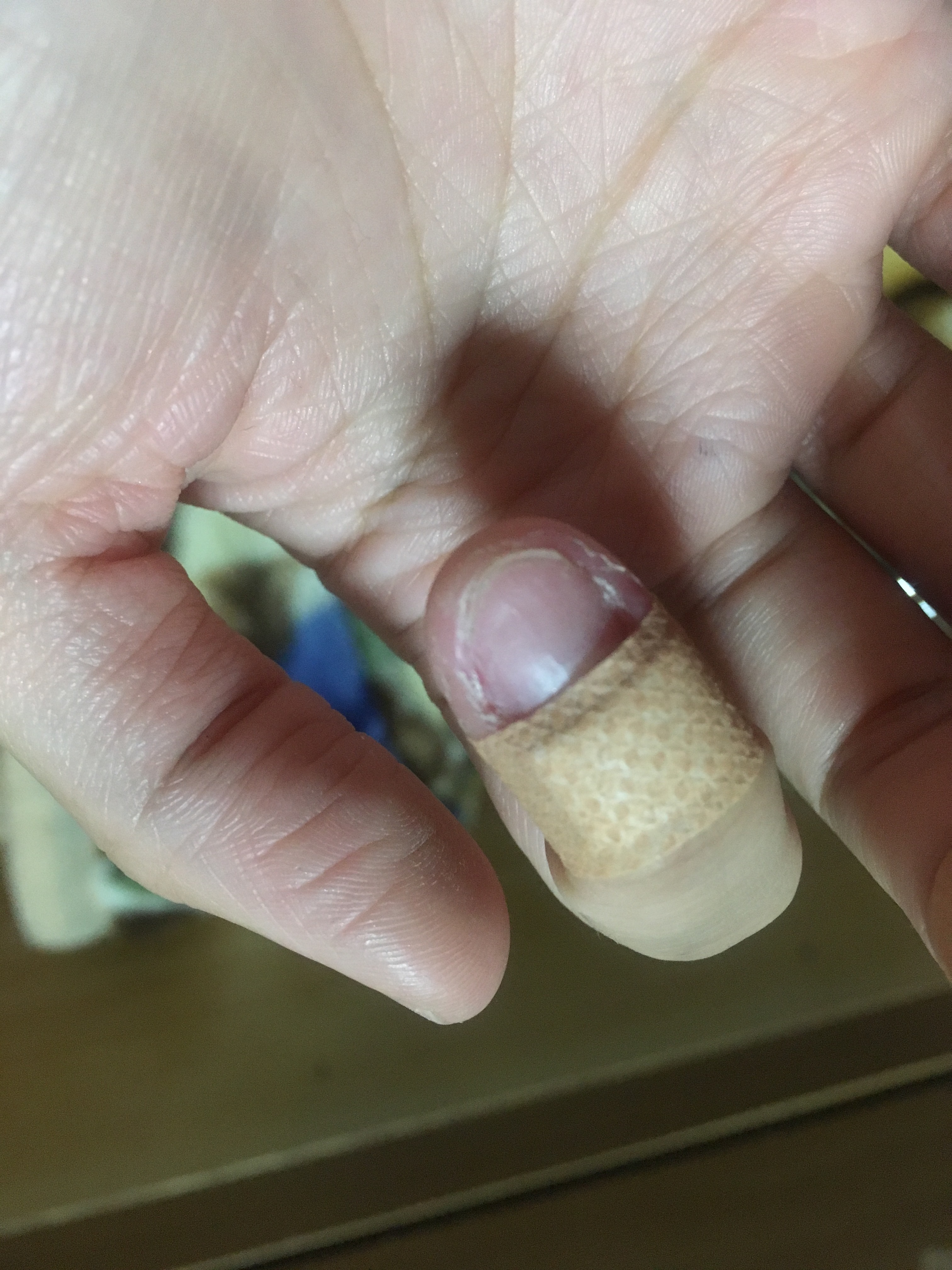 爪の横幅 by 裕行さん の画像