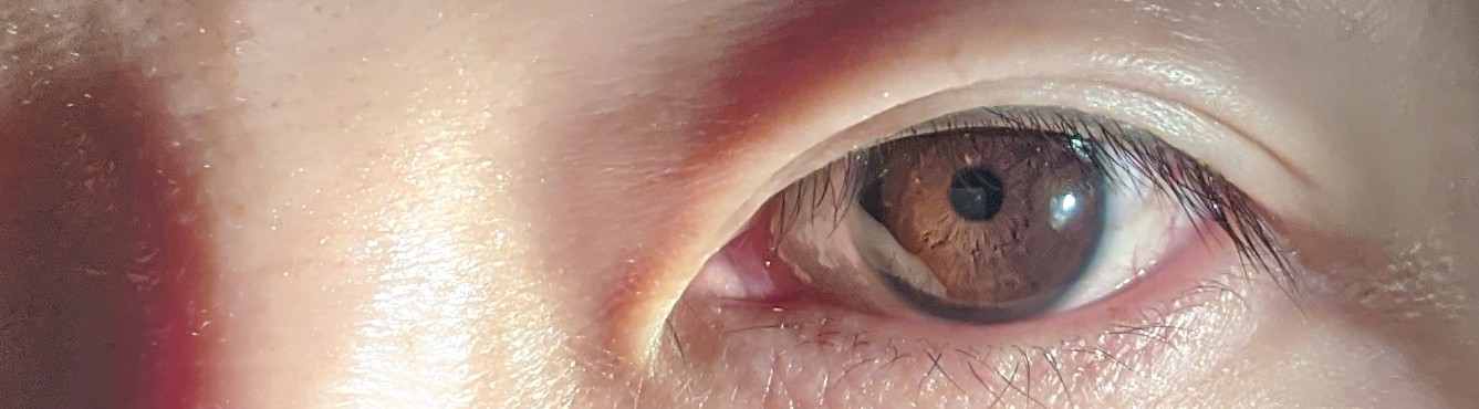 瞳の色 何色ですか 日本人の多くは ダークカラーの Q A Cosme アットコスメ