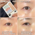 13308171 by **minimaru** さん