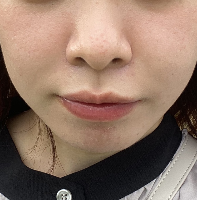 肌管理by 匿名さんの画像