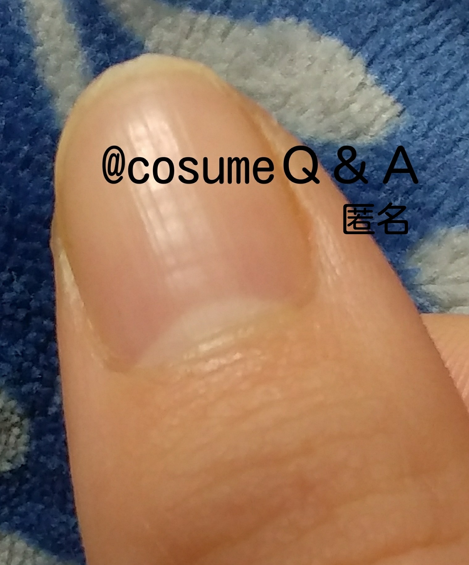 この写真は甘皮が取れていますか 太い指なので載せるか迷 Q A Cosme アットコスメ