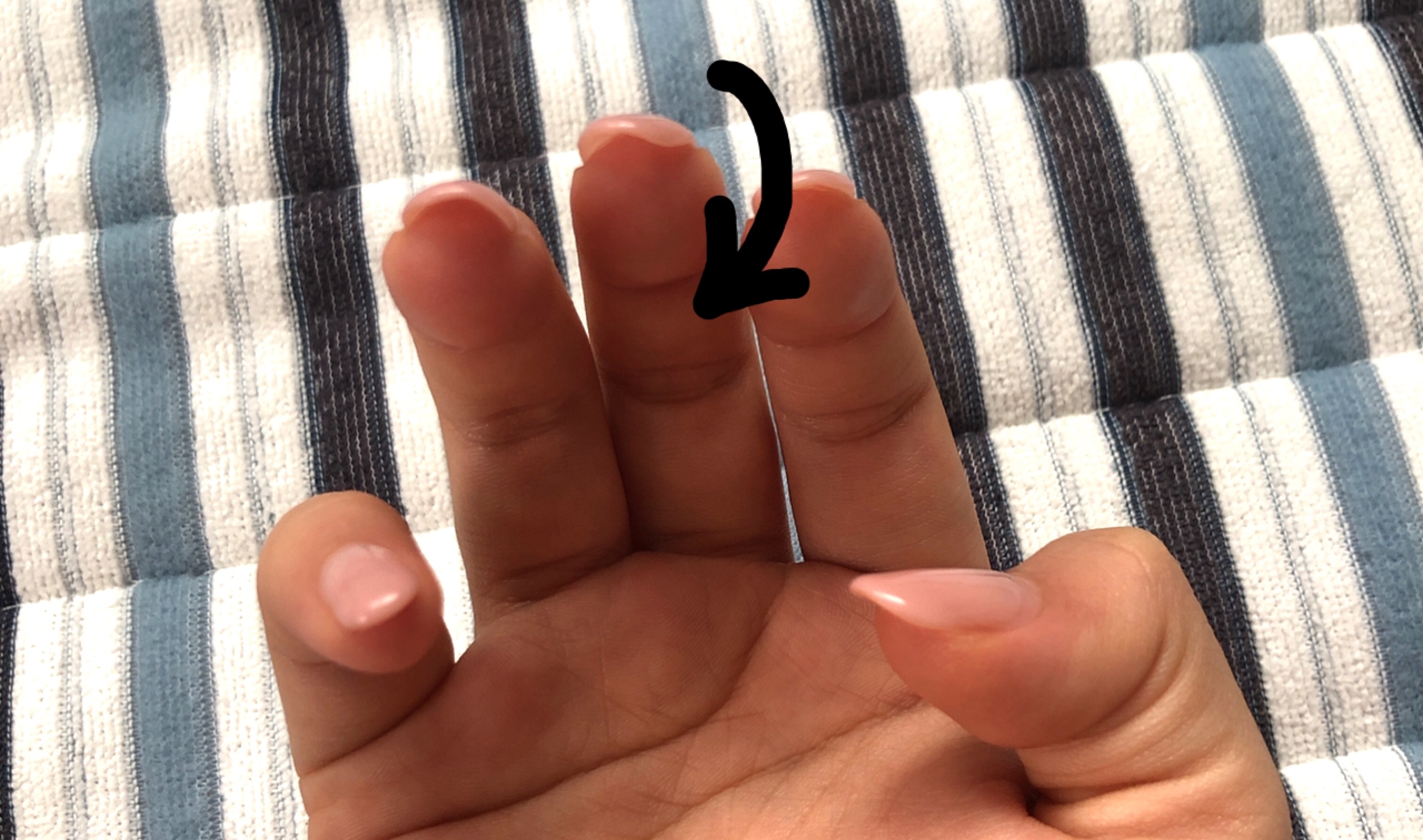 爪の形について 右手中指の爪だけが変形してしまい 改 Q A Cosme アットコスメ