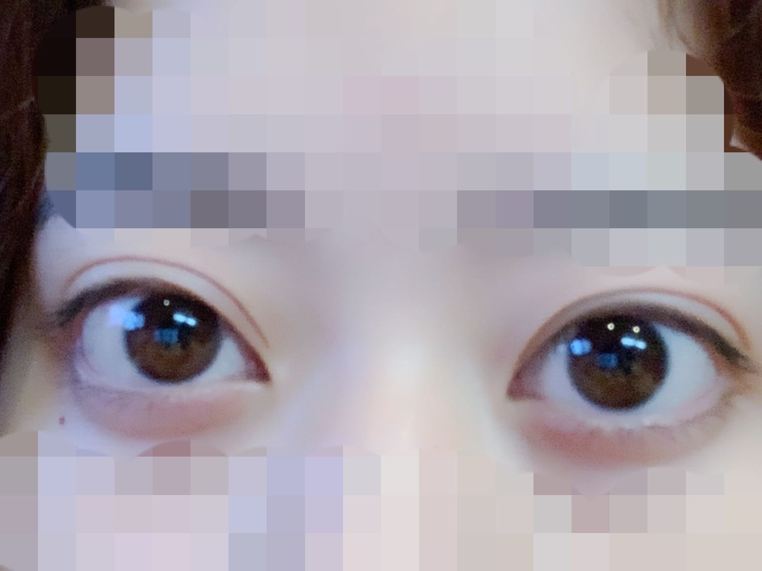 片目だけ腫れぼったい たまに片目だけ二重幅が腫れぼったく Q A Cosme アットコスメ