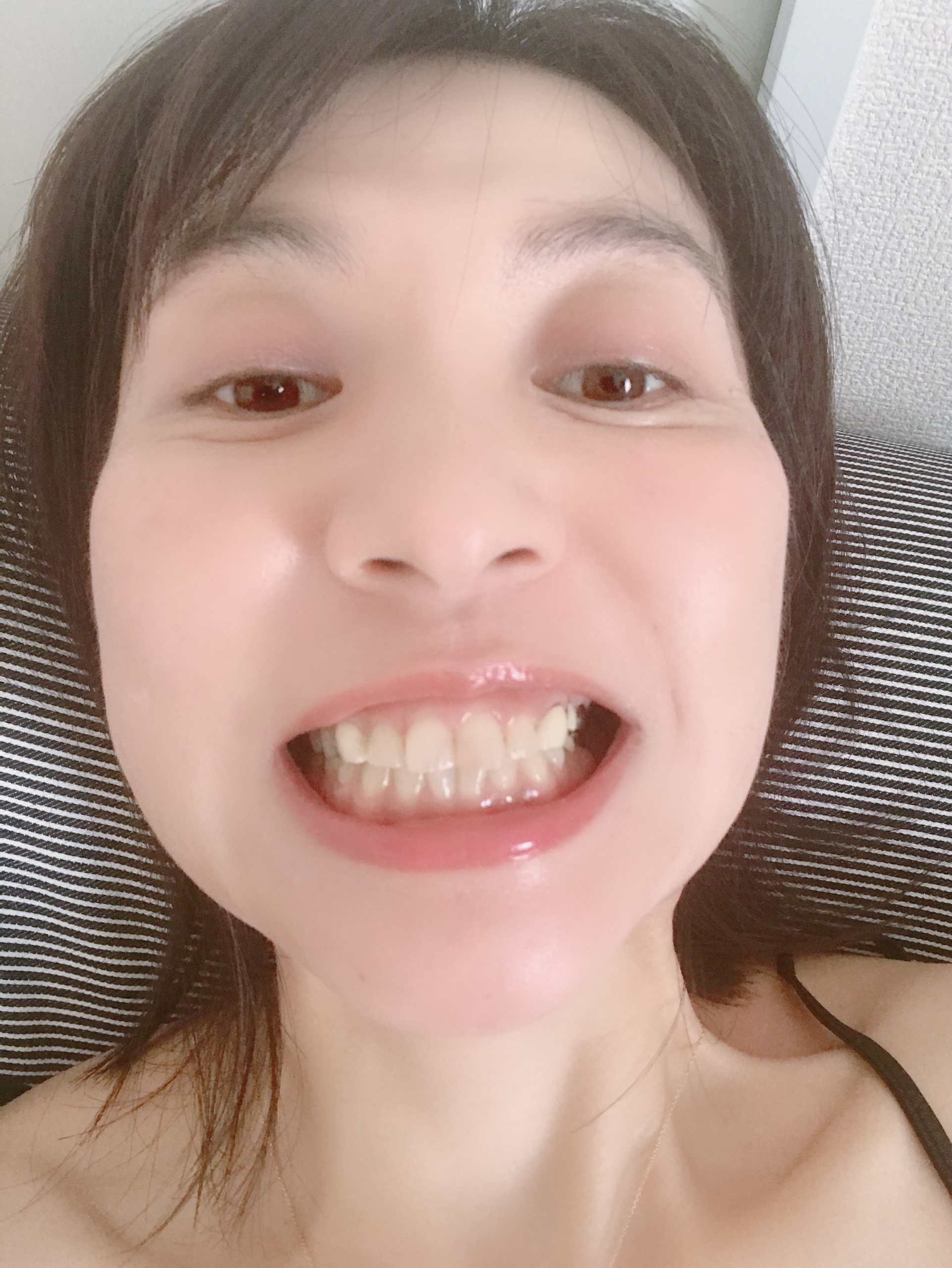 �΂�ᰂ̌�̖ڂ̉��̃}�X�J���̉��J�Xby ���Ђ���􁚂���̉摜