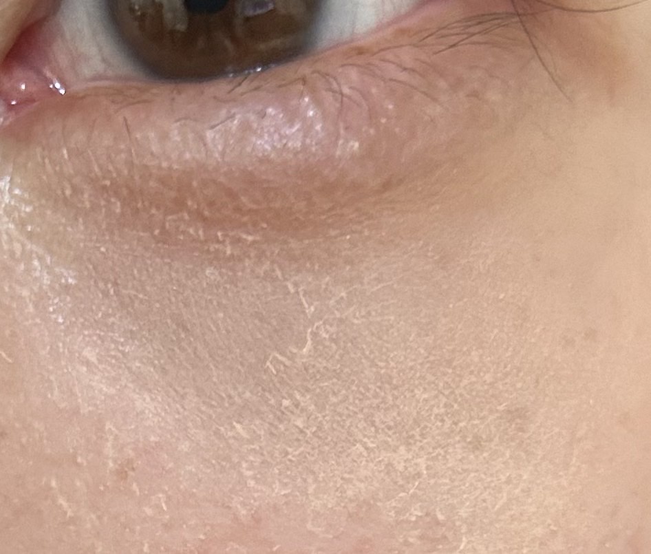 �R���V�[���[��h��Ɣ炪�ނ���by �������ҁ�����̉摜