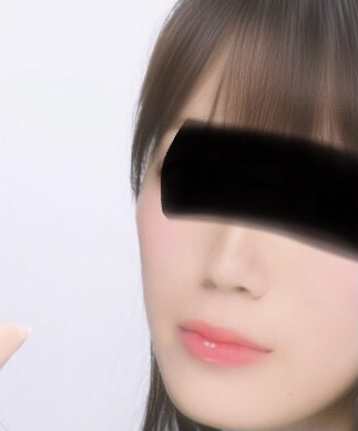 頬骨 by 匿名さん の画像
