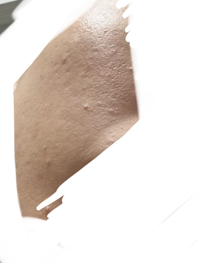 ���r��by ��������̉摜