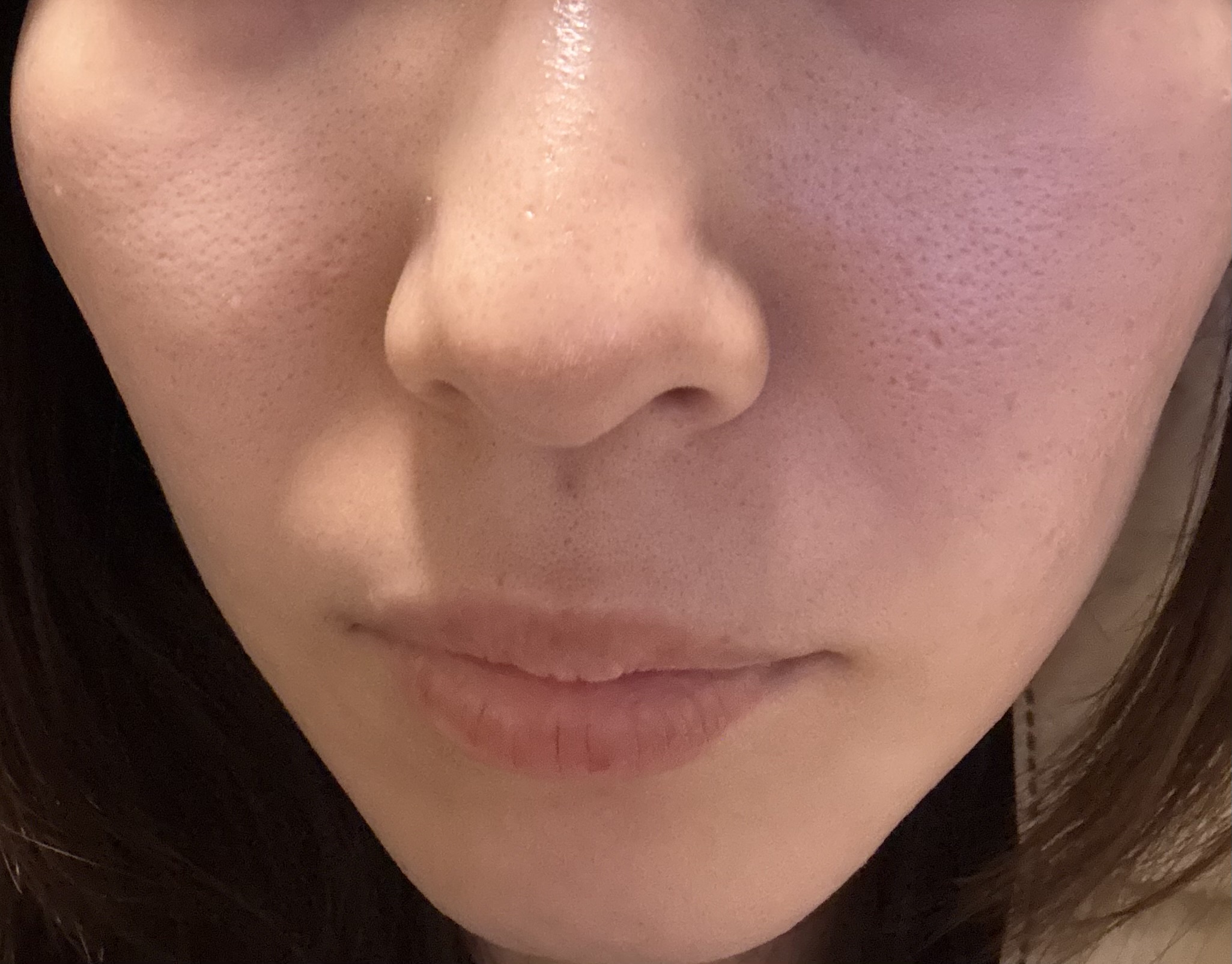 �������P�������ł��I�i�摜����jby ���߂��ア��������̉摜