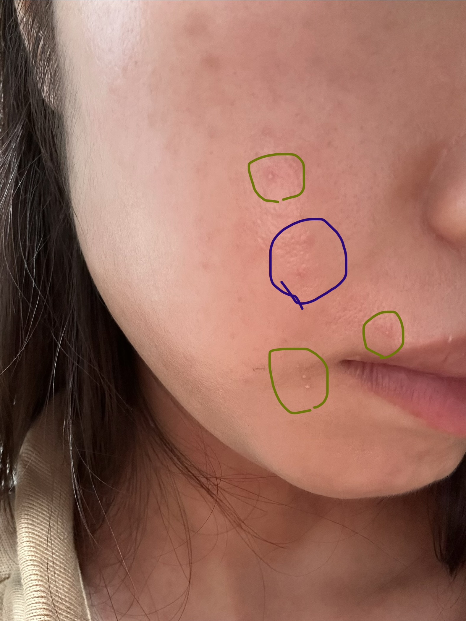 �����Oby �ς񂱁I������̉摜