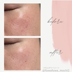 13395083 by omochi..＊ さん