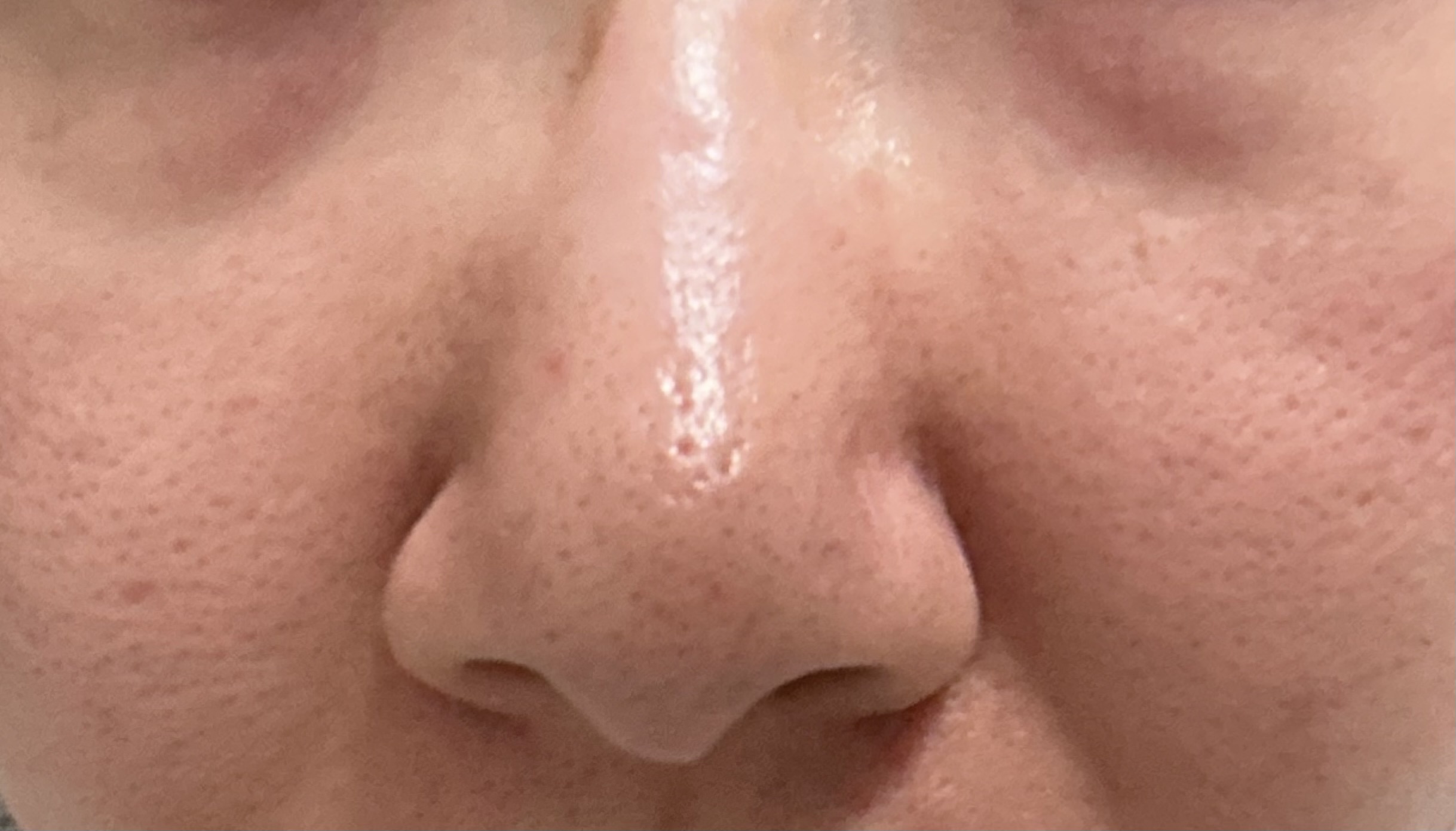 �K�؂ȃX�L���P�A�ɂ���by K��1563����̉摜