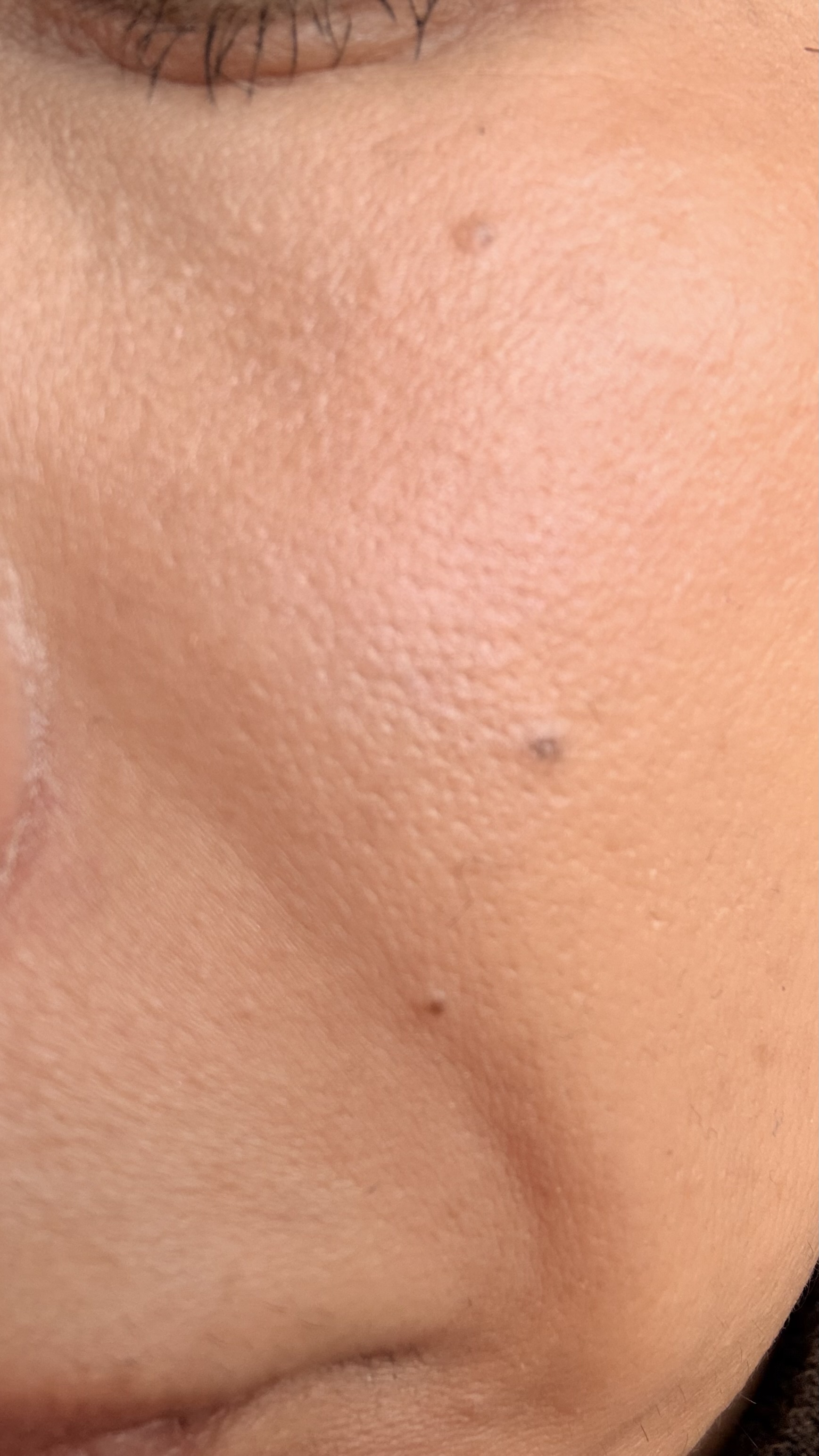 ���@���̃A��by ������P�O�O����̉摜