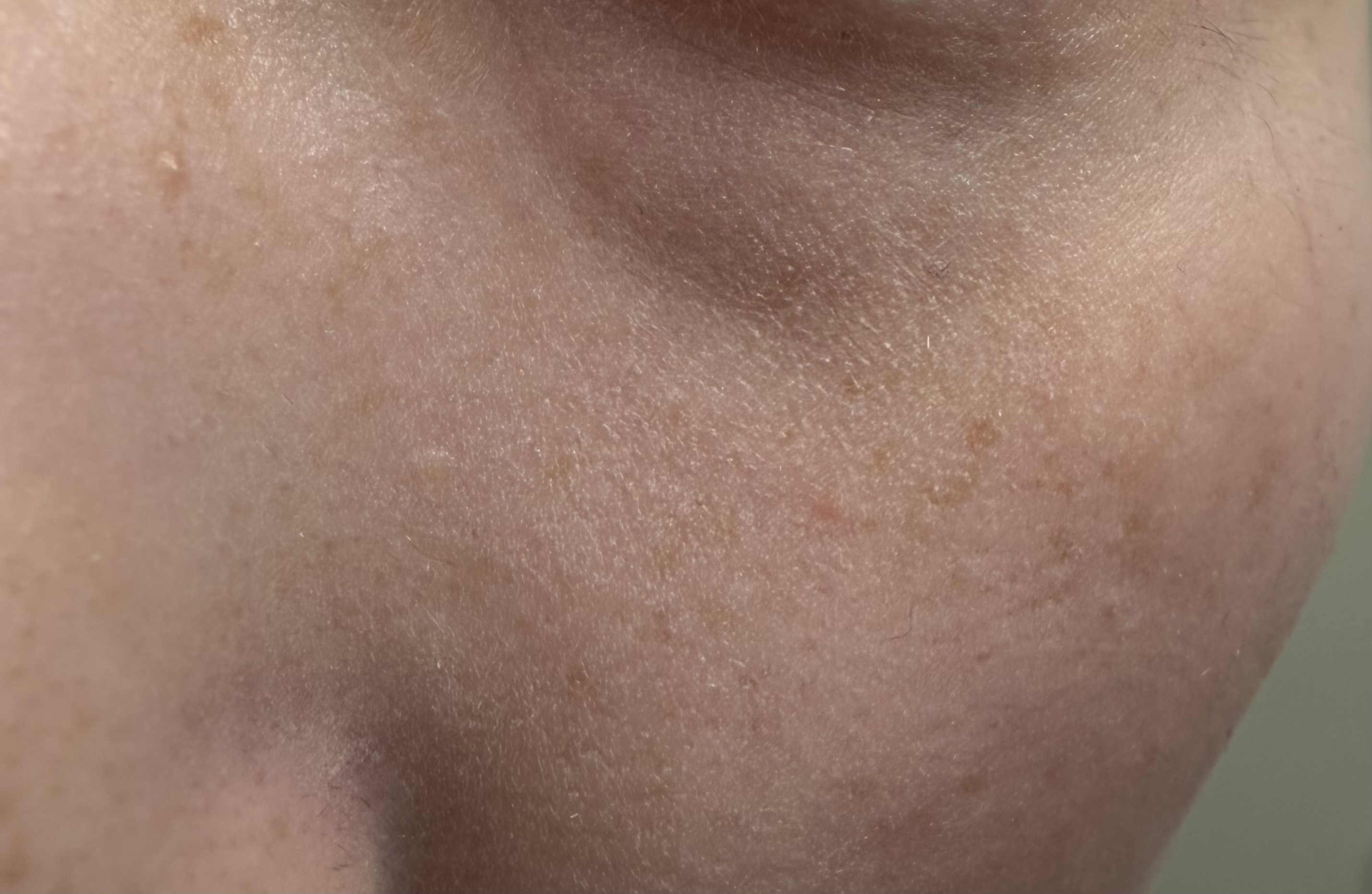 �t�@���f���������Ƃ����Ȃ�܂��A�Aby naaapi22����̉摜