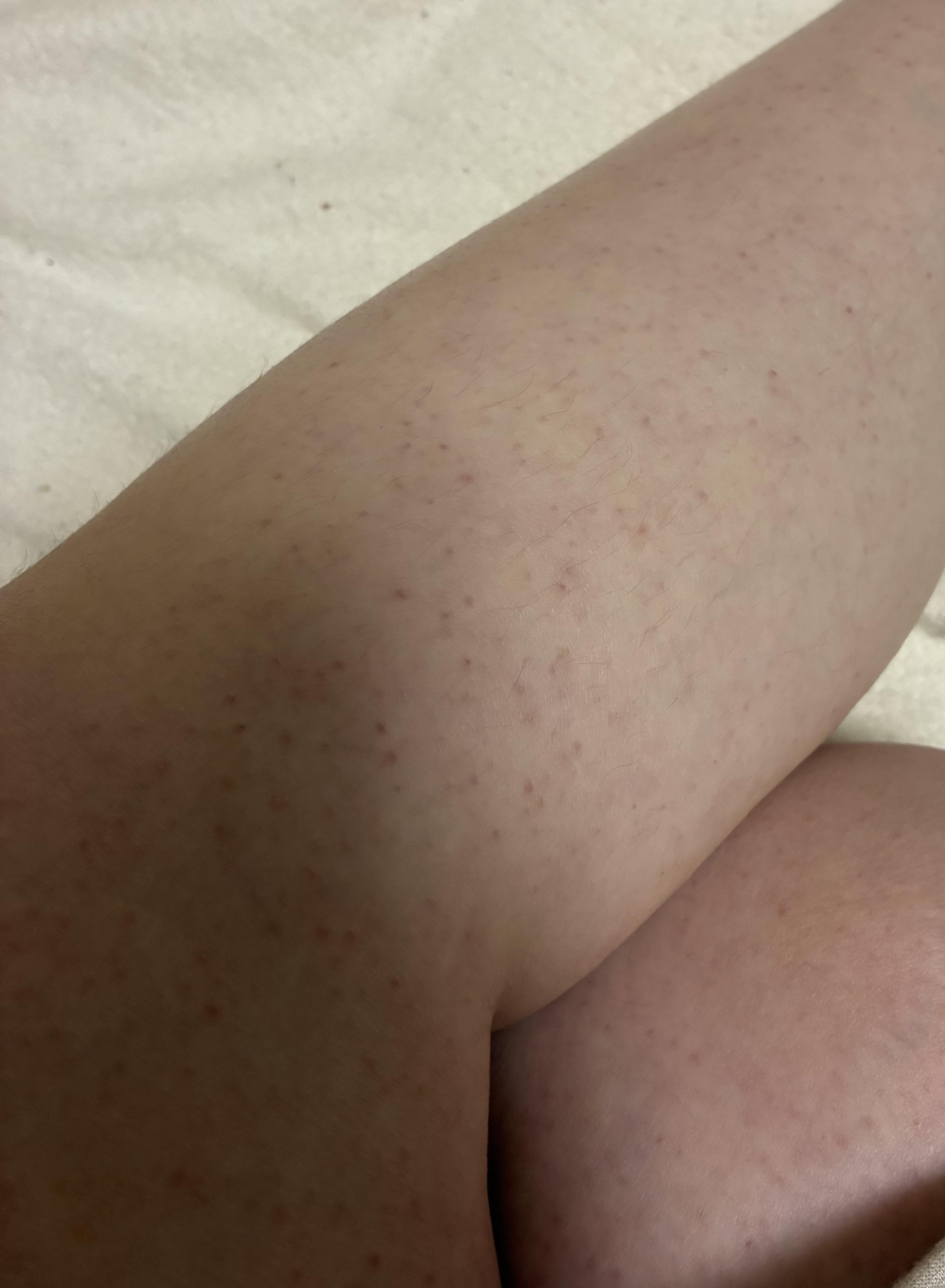 �J�~�\������by ��������̉摜